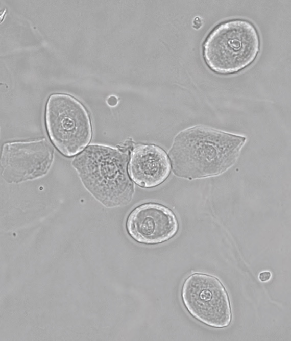 images/AFMS/Products/Core_Lab/Microbiology/Micro-Urineanalysis.jpg#joomlaImage://local-images/AFMS/Products/Core_Lab/Microbiology/Micro-Urineanalysis.jpg?width=570&height=668