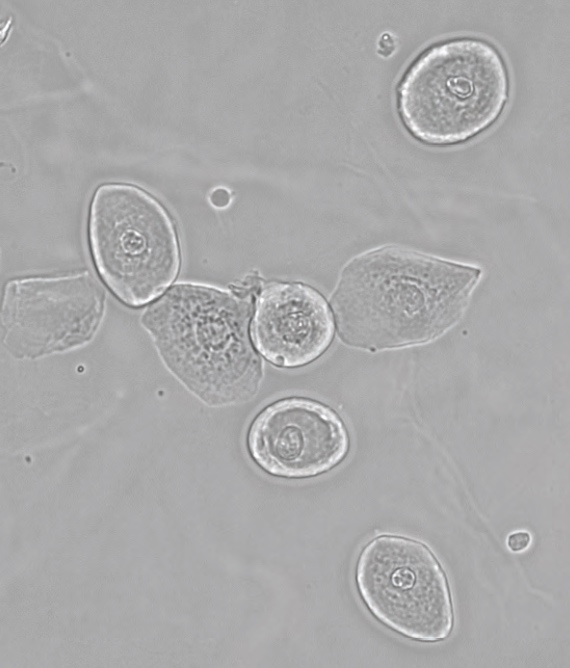 images/AFMS/Products/Core_Lab/Microbiology/Micro-Urineanalysis.jpg#joomlaImage://local-images/AFMS/Products/Core_Lab/Microbiology/Micro-Urineanalysis.jpg?width=570&height=668