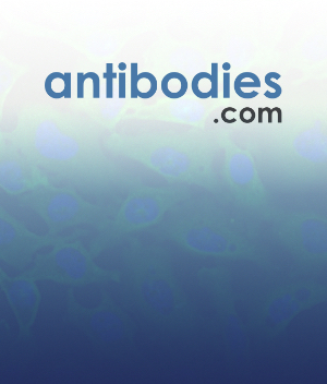 images/AFMS/Products/LifeSciences/LS-AntibodiesProductLine2.jpg#joomlaImage://local-images/AFMS/Products/LifeSciences/LS-AntibodiesProductLine2.jpg?width=300&height=352